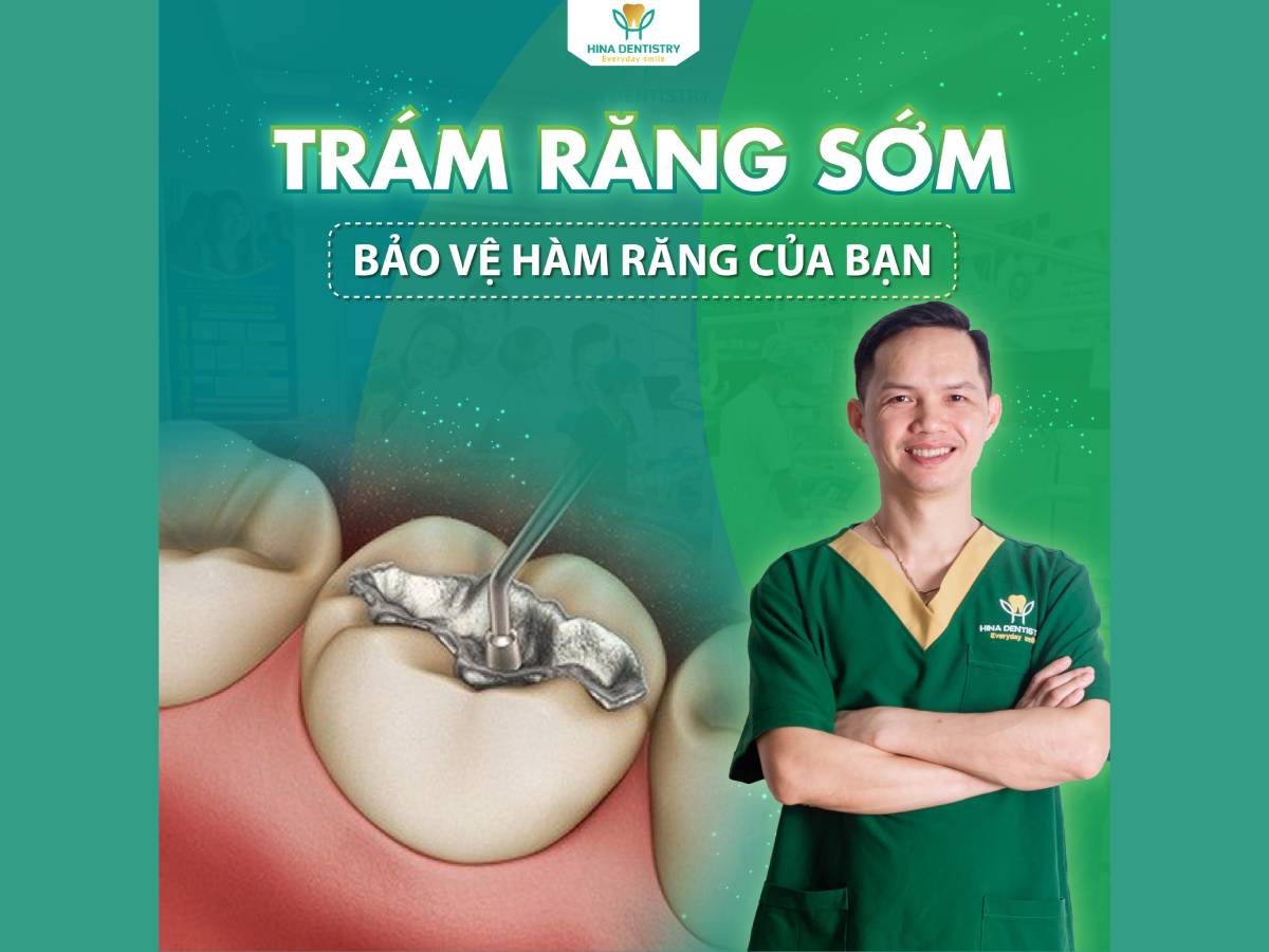 Trám răng sớm, bảo vệ hàm răng của bạn
