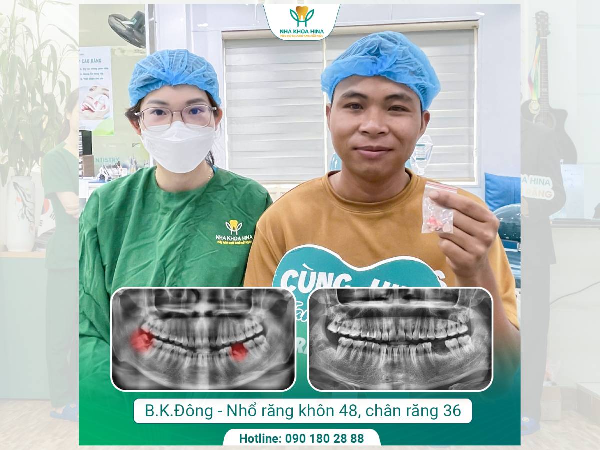BÍ QUYẾT ĐỂ KHÔNG CÒN SỢ NHỔ RĂNG KHÔN: CHỌN ĐÚNG BÁC SĨ