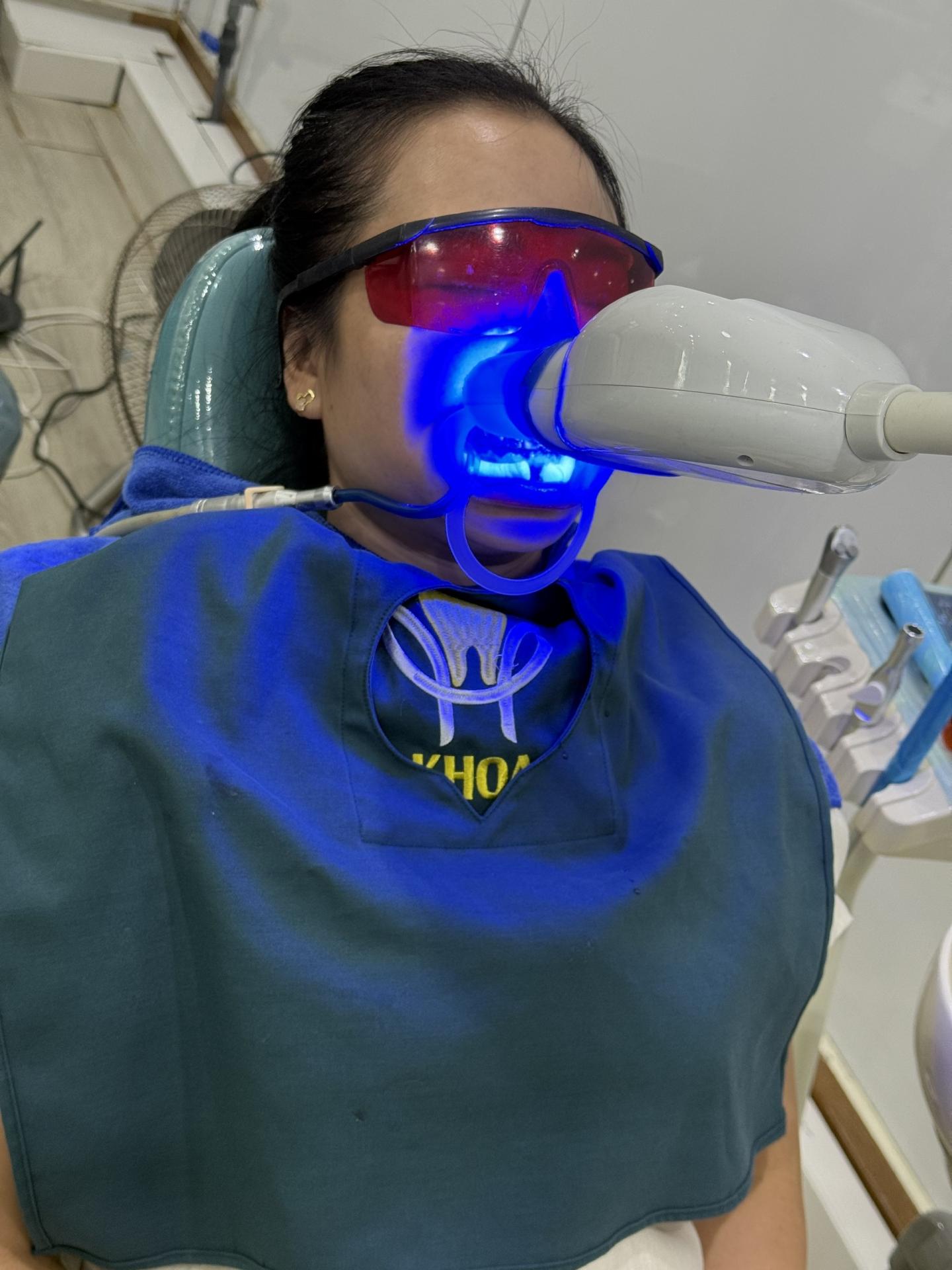 Tẩy Trắng Răng – Giải Pháp Cho Nụ Cười Tỏa Sáng