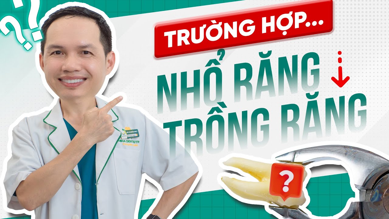 Khi Nào Cần Nhổ Răng và Khi Nào Cần Trồng Răng