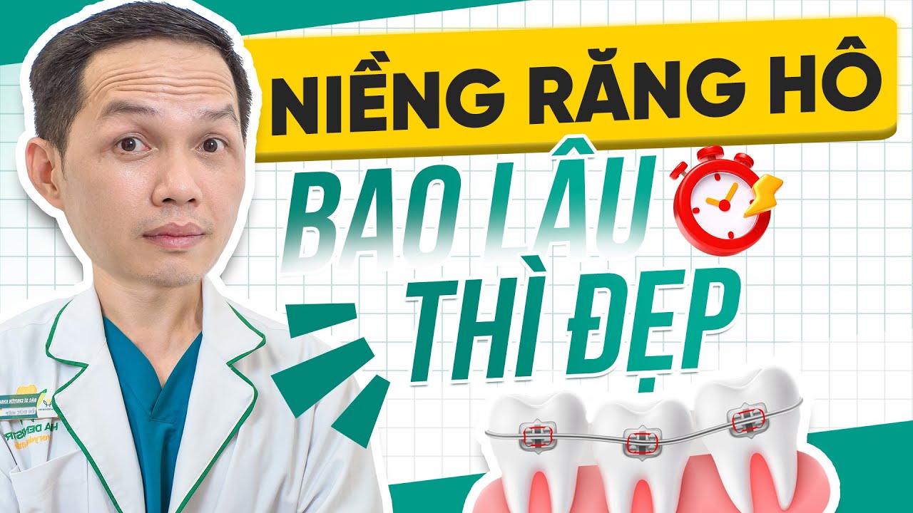 Niềng Răng Hô Bao Lâu Thì Đẹp