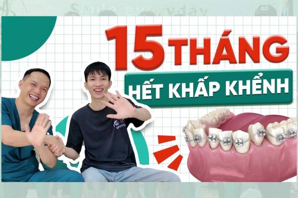 Hết Răng Khấp Khểnh Sau 15 Tháng – Bí Quyết Thành Công | Nha Khoa Hina