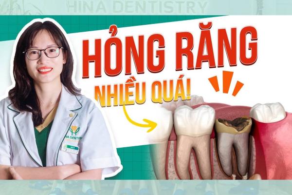 Cảnh Báo: Viêm Tủy Âm Thầm Làm Hỏng Cả Hàm Răng 