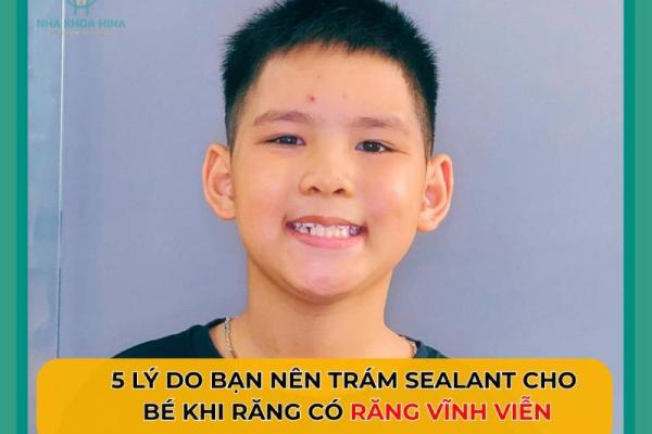 5 Lý do bạn nên trám Sealant cho bé ngay khi có răng vĩnh viễn 5 Lý do bạn nên trám Sealant cho bé ngay khi có răng vĩnh viễn