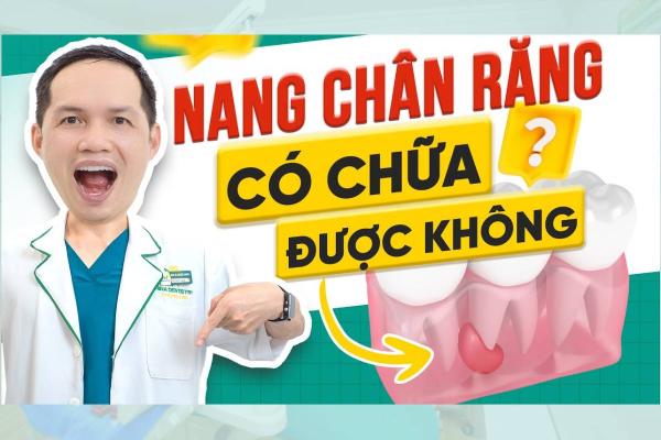 Đừng Chủ Quan Với Nang Chân Răng - Có Thể Chữa Được Không Đừng Chủ Quan Với Nang Chân Răng - Có Thể Chữa Được Không