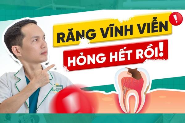 Nguy cơ hỏng răng vĩnh viễn do răng mọc ngầm