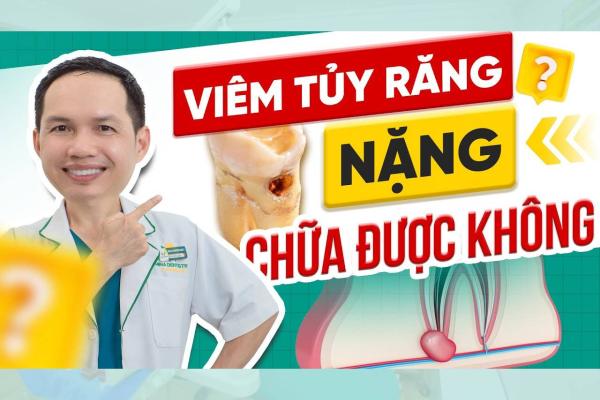 Viêm Tủy Răng Nặng Có Chữa Được Không?