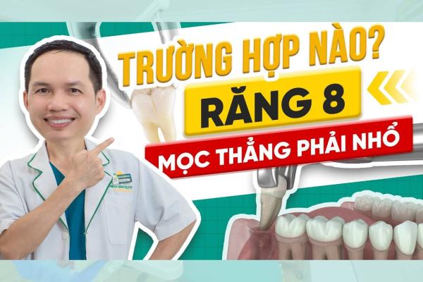 Răng Khôn Mọc Thẳng Có Cần Nhổ Không