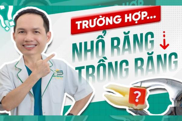 Khi Nào Cần Nhổ Răng Hay Trồng Răng