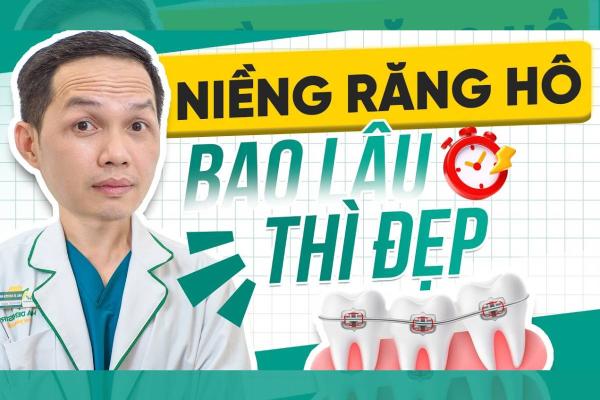 Niềng Răng Hô Bao Lâu Thì Đẹp
