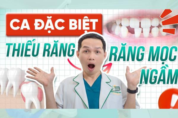 Thiếu Răng, Răng Mọc Ngầm Có Niềng Được Không