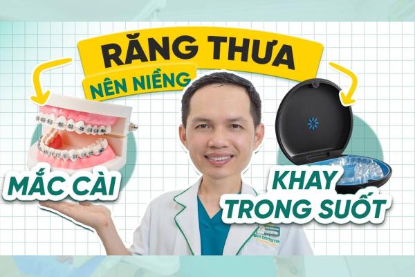 Đóng Khe Thưa Nên Chọn Mắc Cài Hay Khay Trong Suốt