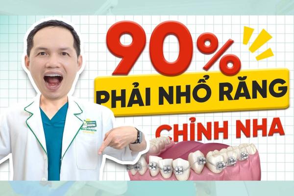90% Người Gặp Trường Hợp Này Đều Phải Nhổ Răng Khi Chỉnh Nha 