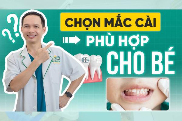 Loại Mắc Cài Nào Tốt Nhất Cho Trẻ Em