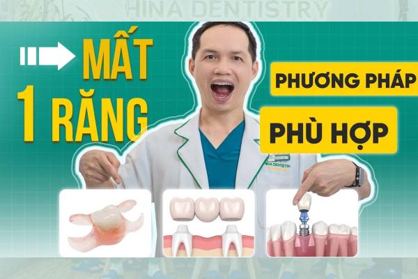 Mất 1 Răng Có Cần Làm Gì Không