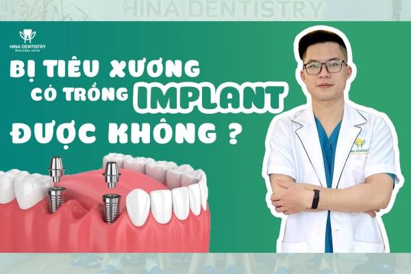Bị Tiêu Xương Có Trồng Răng Implant Được Không