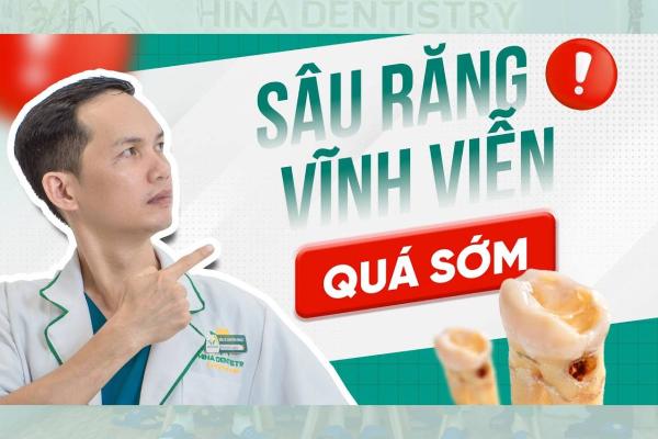 Bác Sĩ Giải Đáp Về Sâu Răng Vĩnh Viễn Sớm